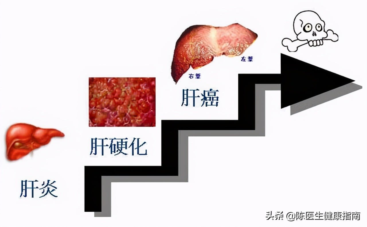 李兰娟乙肝病毒量,李兰娟院士谈乙肝最好的药物