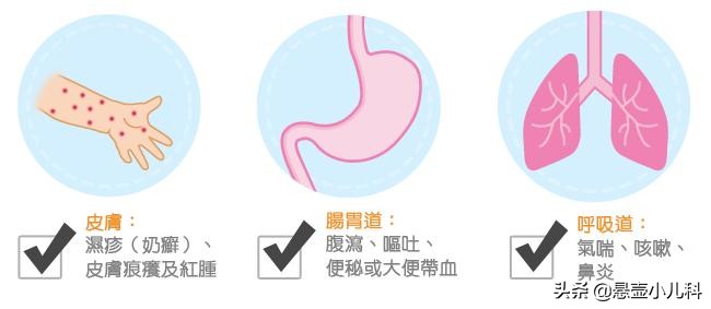 辟谣:牛奶蛋白过敏宝宝可以吃羊奶或豆奶替代？医生告诉你真相