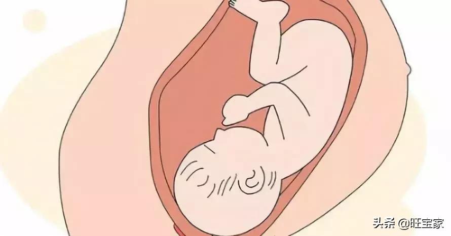 林允儿的o型腿,林允儿的o型腿走路