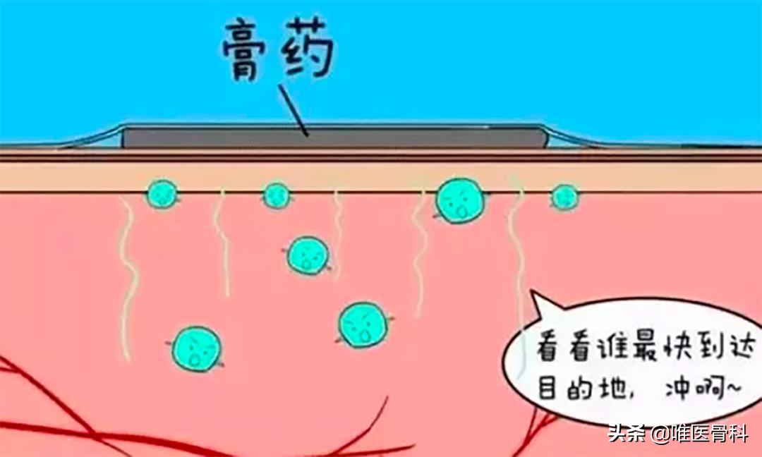 腰酸背痛千万别用膏药,腰酸背痛就贴膏药