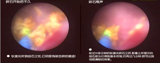 山东治疗泌尿外科比较好的医院,山东大学附属医院泌尿外科专家