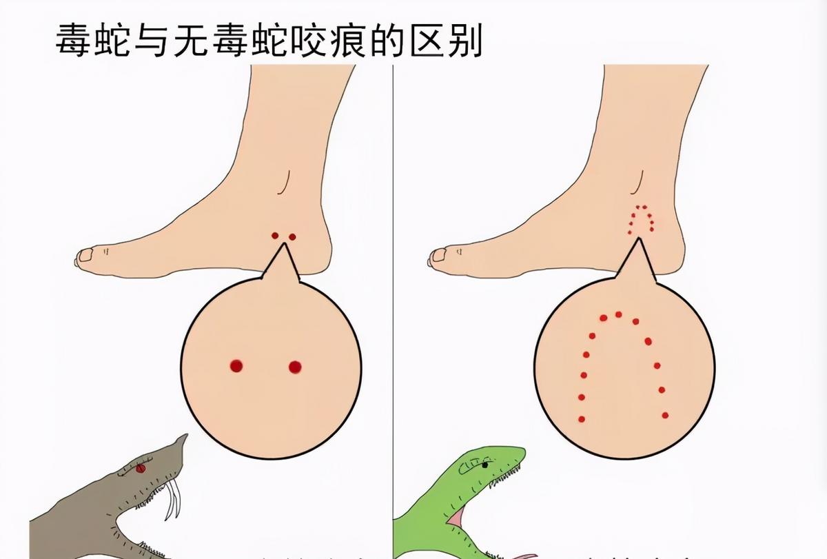 家里进了蛇为什么不能打死,家里出现蛇能不能打死
