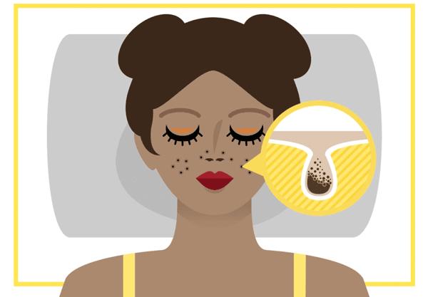 吃什么能有效的淡斑祛斑,如何才能方便有效的祛斑淡斑