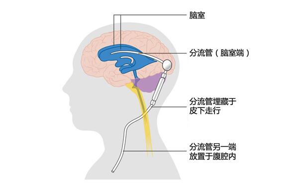 老迷糊啥原因呢,老犯迷糊睡不醒是怎么回事
