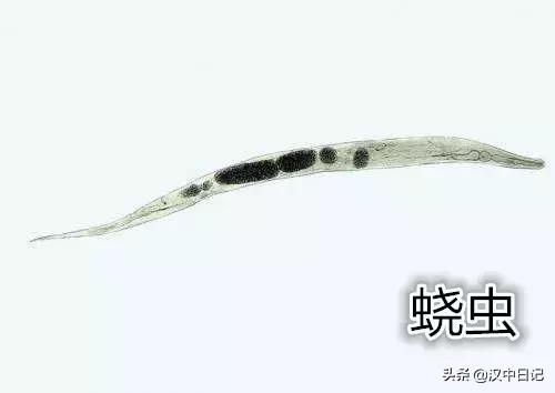 6岁宝宝怎么能判断身体有没有虫,孩子身体有虫子怎么才能查出来
