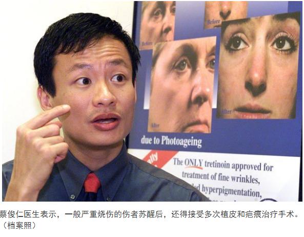 26岁女星冲入火海救男友被严重烧伤，多次手术后仍未脱离危险期