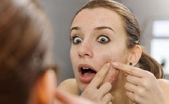 祛痘后开始爆痘原因有哪些,易长痘怎么祛痘痘小妙招