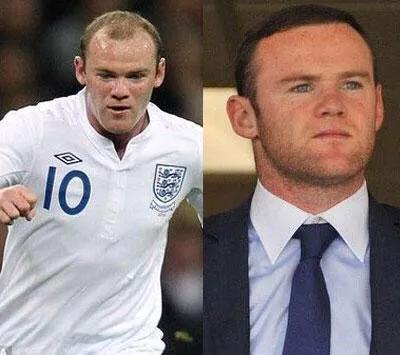 鲁尼经历了什么,鲁尼双翼齐飞