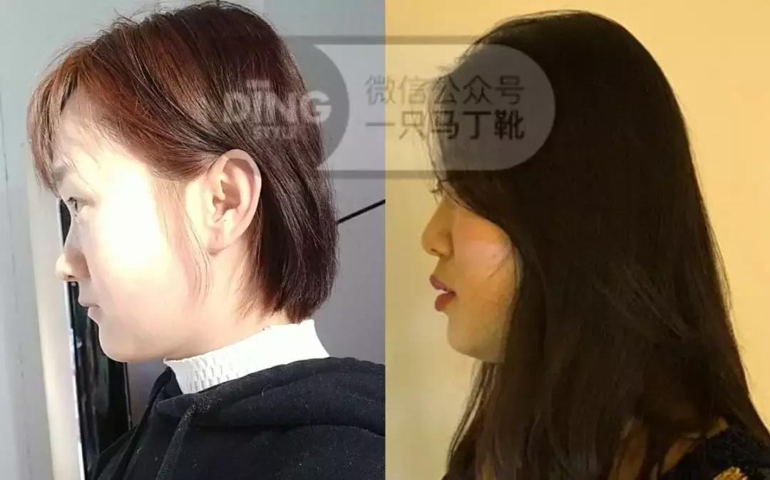 扁头有什么办法改善头型吗,扁头怎么让头变得饱满些