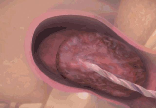 3D实图还原女性分娩全过程，没有一个妈妈能笑着看完