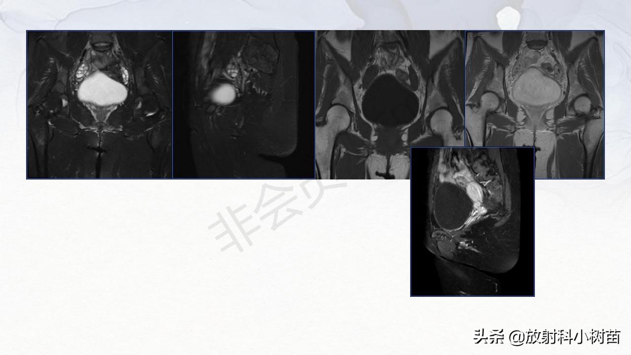 女性盆腔mri解剖图谱,泌尿生殖系统x线解剖