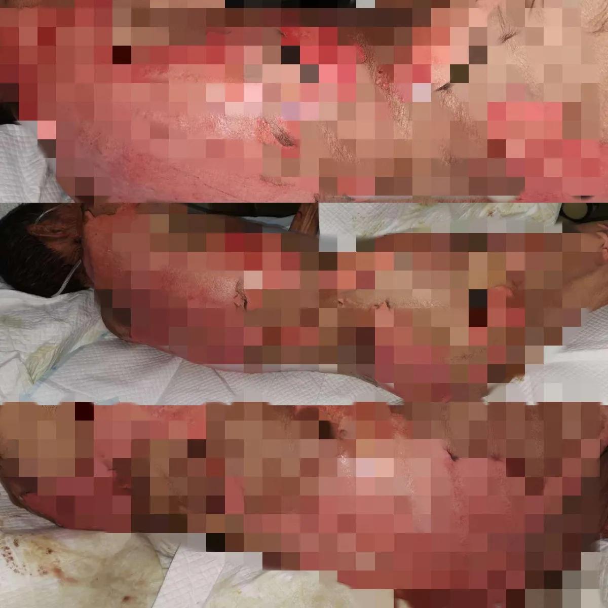 鑰佷汉韬綋琛扮鐨偆婧冪儌,鍗у簥鑰佷汉韬綋鐨偆婧冪儌鐢ㄤ粈涔堣嵂