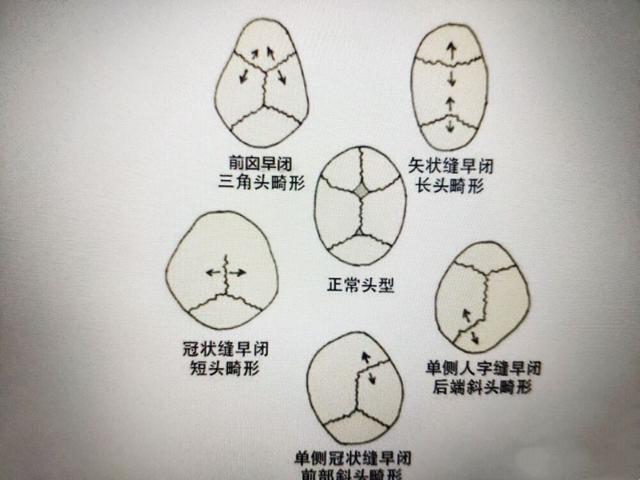 岳云鹏老婆再剃光头,岳云鹏老婆为什么剃光头