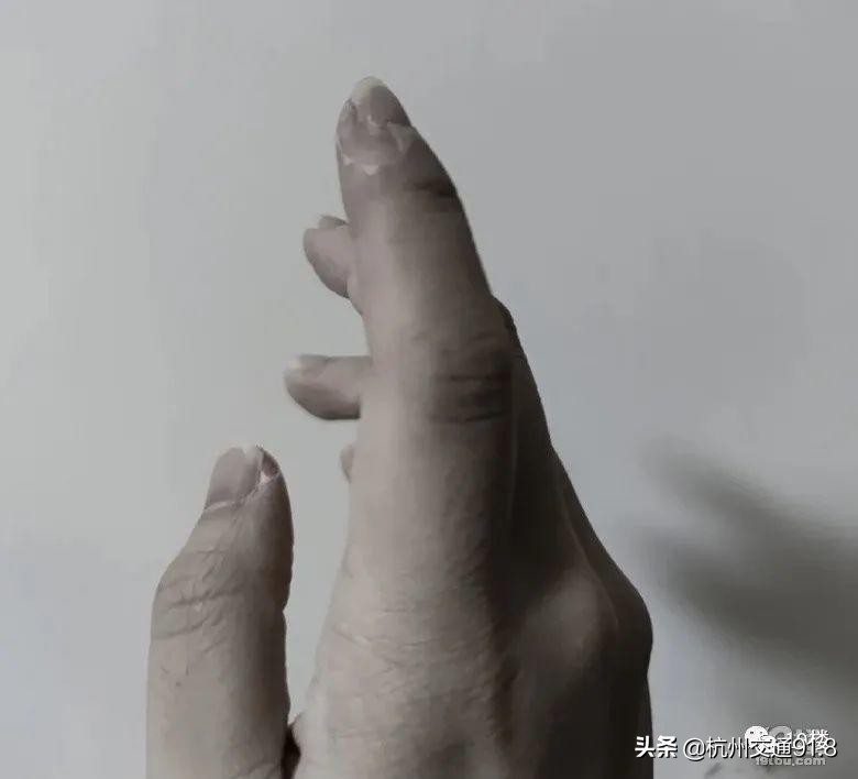 90后姑娘熬夜10年长出老年斑,杭州姑娘熬夜