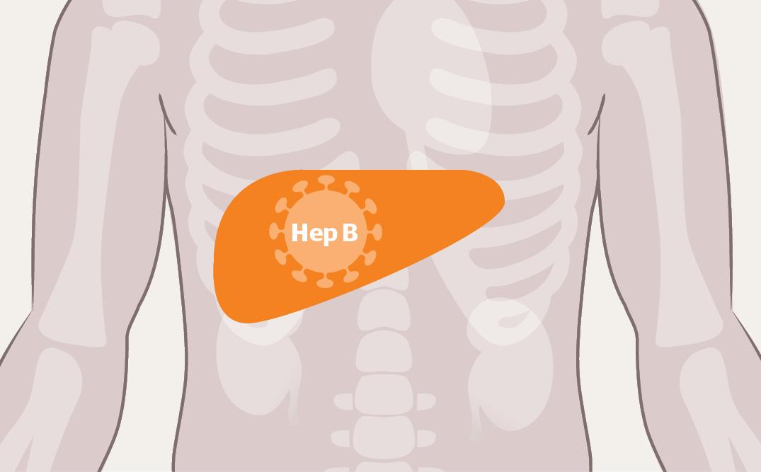 家里有乙肝患者应怎样消毒,医院乙肝病人住后咋打扫
