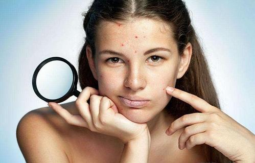 痘痘反复发炎怎么办,痘痘肌反反复复怎么改善