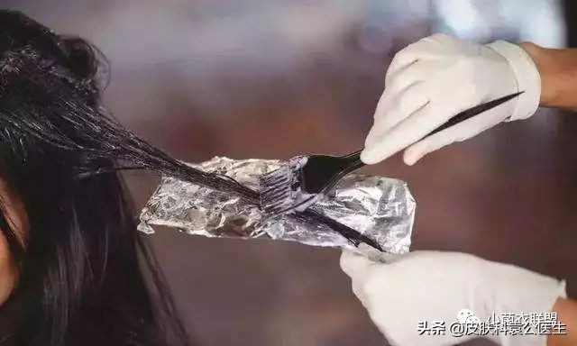 脱发严重但是头发还是很浓密,脱发头发油腻怎么办