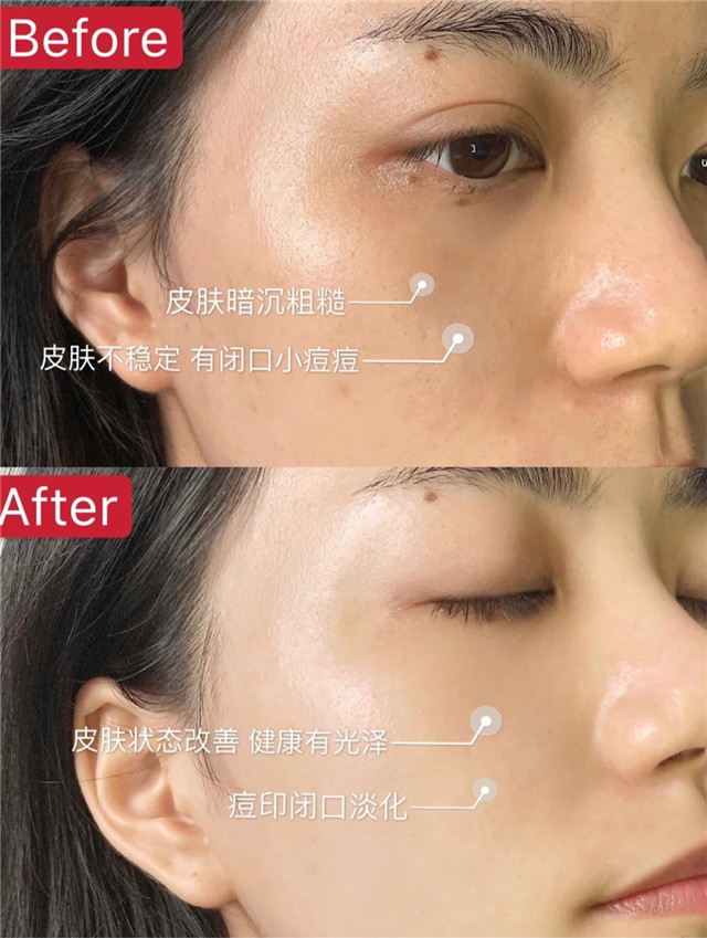 清水洗脸反而比洗面奶更好,清水洗脸和补水区别