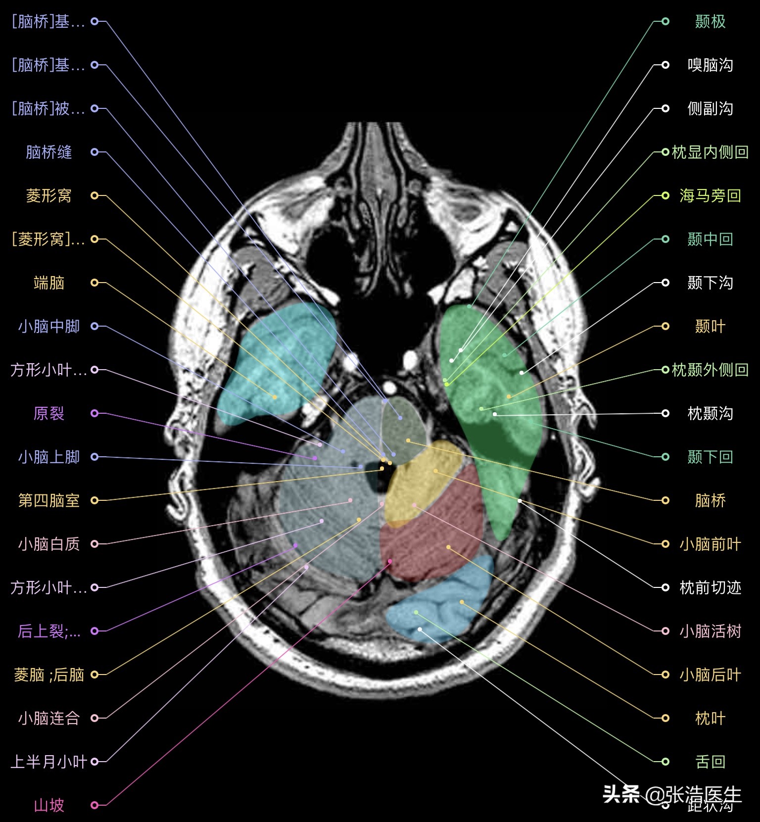 颅脑mri断层解剖视频课件,颅脑mri解剖手绘图