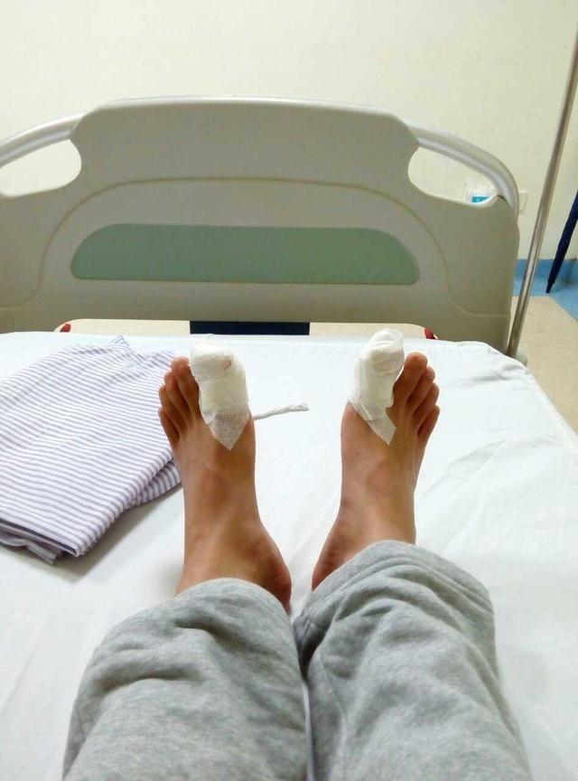 甲沟炎经验分享,甲沟炎的自愈经历