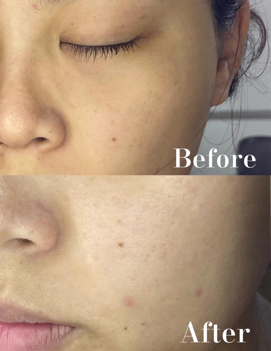 国货水乳便宜好用,羽西和薇诺娜水乳对比