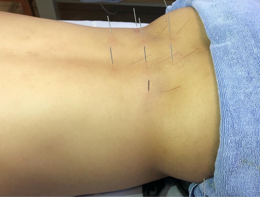 久坐腰酸是肾虚还是腰肌劳损,久坐不动腰酸腰痛来试试这3招