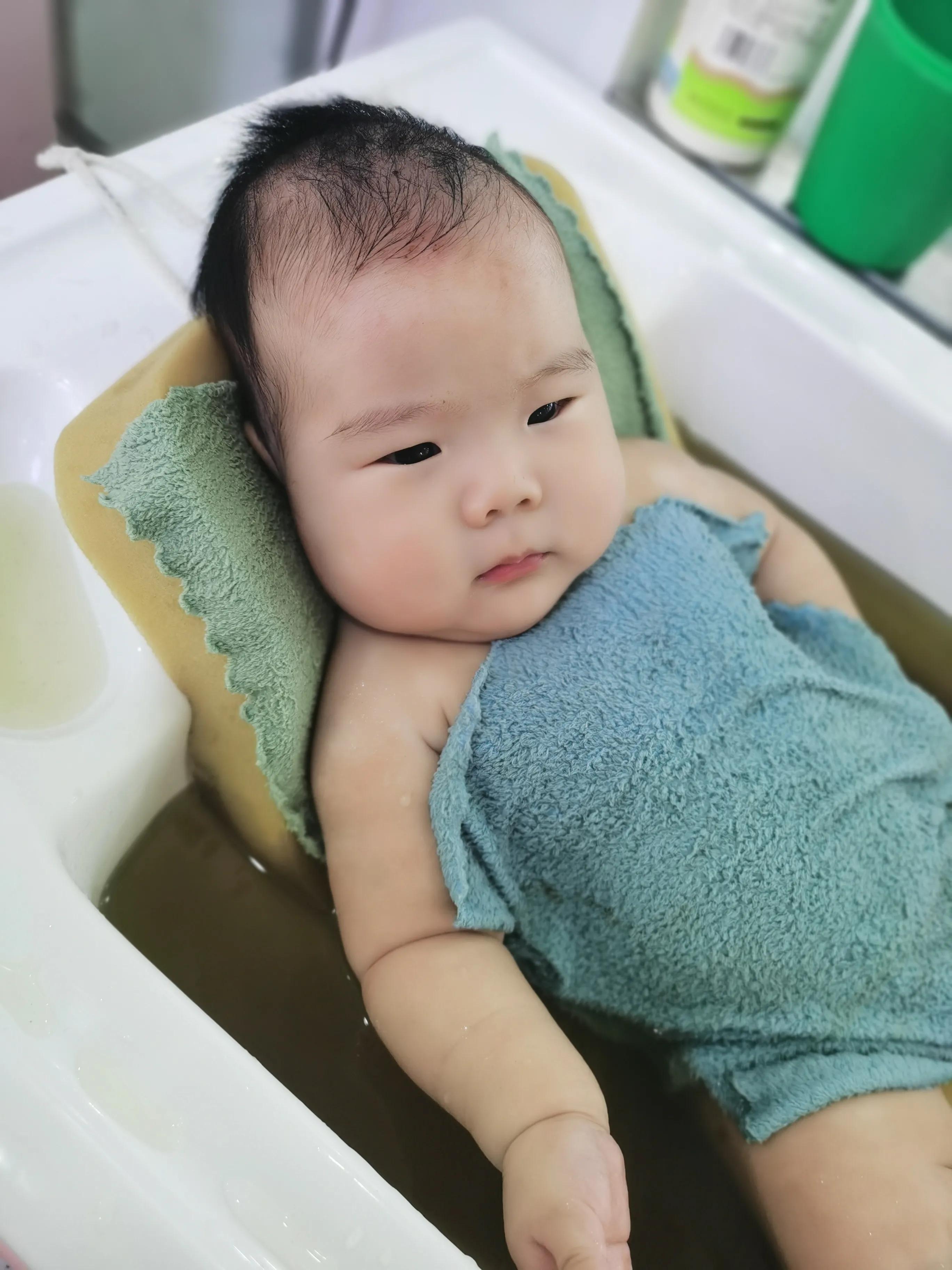 3个月宝宝褶皱处破损怎么办,婴儿颈部褶皱处发红破损怎么办