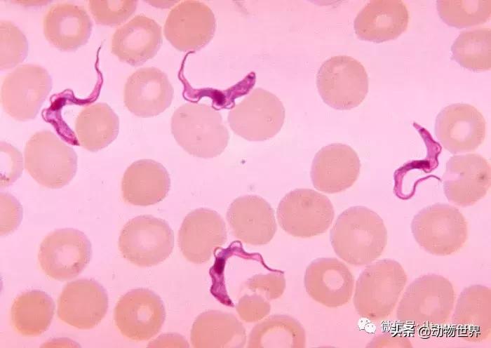 昏睡病能治吗,昏睡跟嗜睡