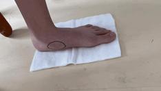 儿童扁平足的矫正训练,儿童矫正扁平足的最佳锻炼方法