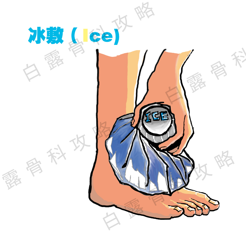 崴脚急诊能处理吗,疫情在家崴脚怎么处理