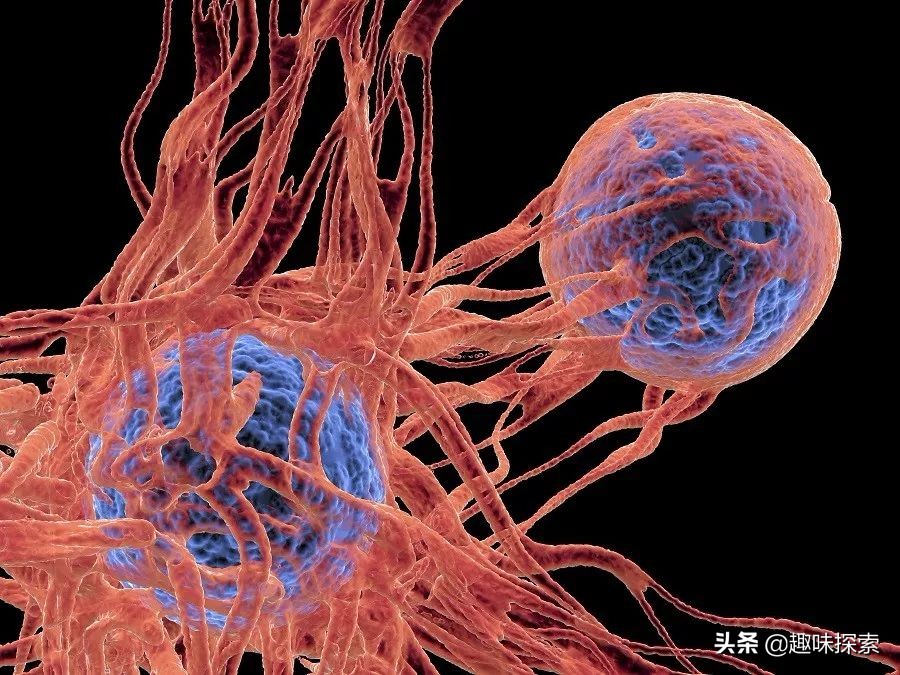 以色列治疗癌症最佳方案,以色列称已发明治疗癌症新方法