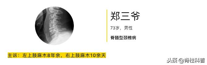 颈椎病治疗的分享,关于颈椎病通俗易懂的科普
