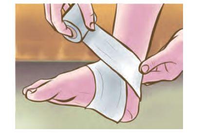 教你脚踝扭伤的正确紧急处理方法,脚踝扭伤后该怎么用药