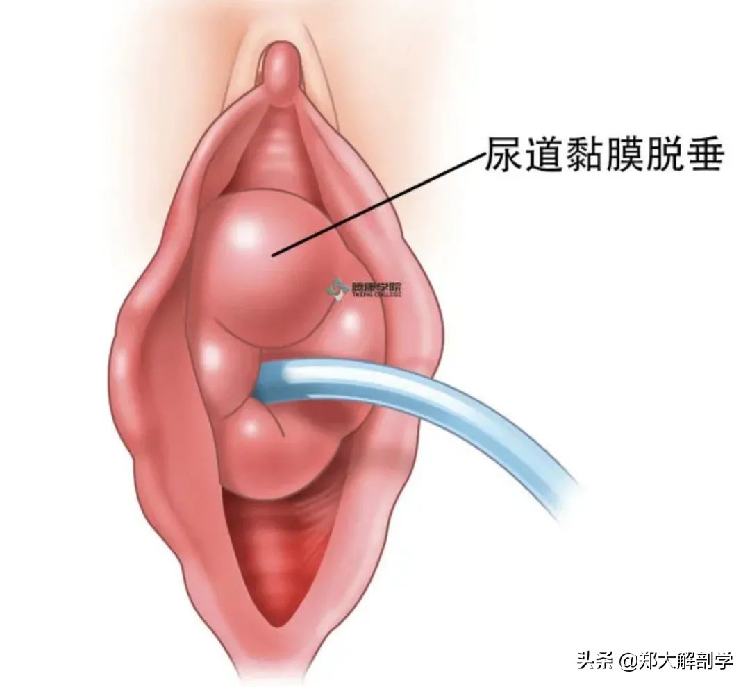 女性盆底功能障碍性疾病表现,南通治疗盆底功能障碍的医院