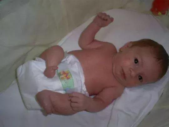 因为卫生棉条被截肢,女星因为卫生巾截肢