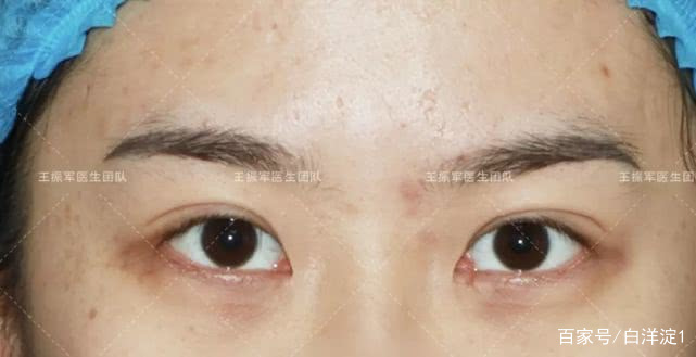 名门泽佳的正确涂法,名门泽佳祛皱小细节