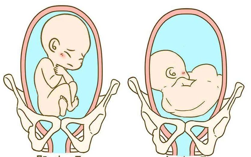 预产期即将到迟迟不发动,预产期到了胎儿没入盆怎么回事