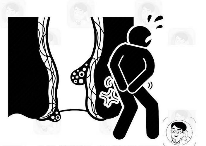 肛门瘙痒难耐，7种病因，轻重不一，都别大意