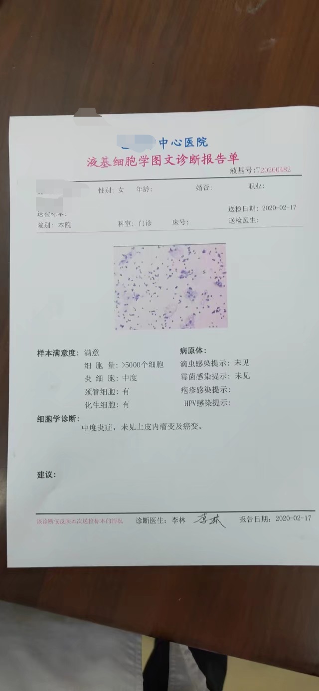 女人有妇科困扰吗,女人常见的妇科问题