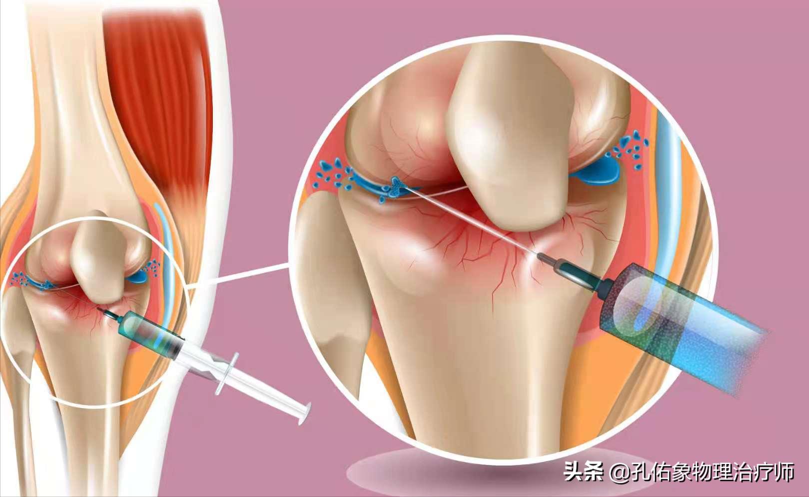 老年人腿脚无力要怎么避免,专治老年人下肢无力的方法