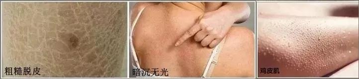 去角质的搓澡巾,加厚去角质搓澡巾