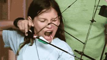 牙齿矫正与牙齿正畸,正畸矫正最佳方法