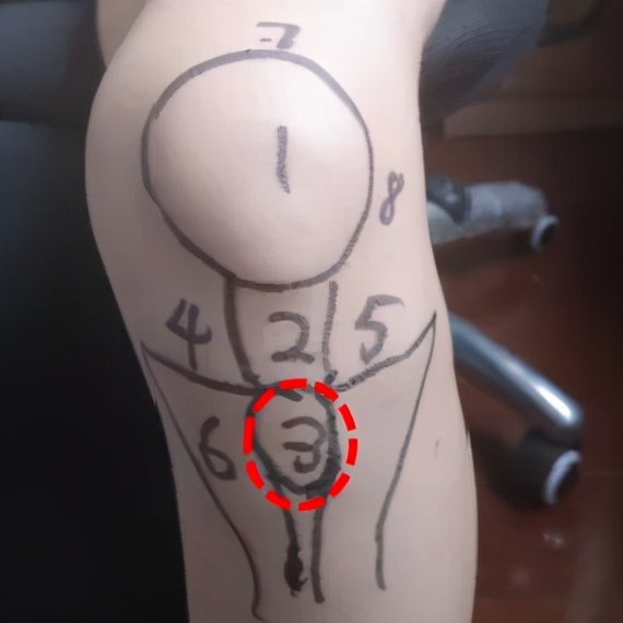 骨科医生教你一招搞定膝盖痛,不同部位膝关节