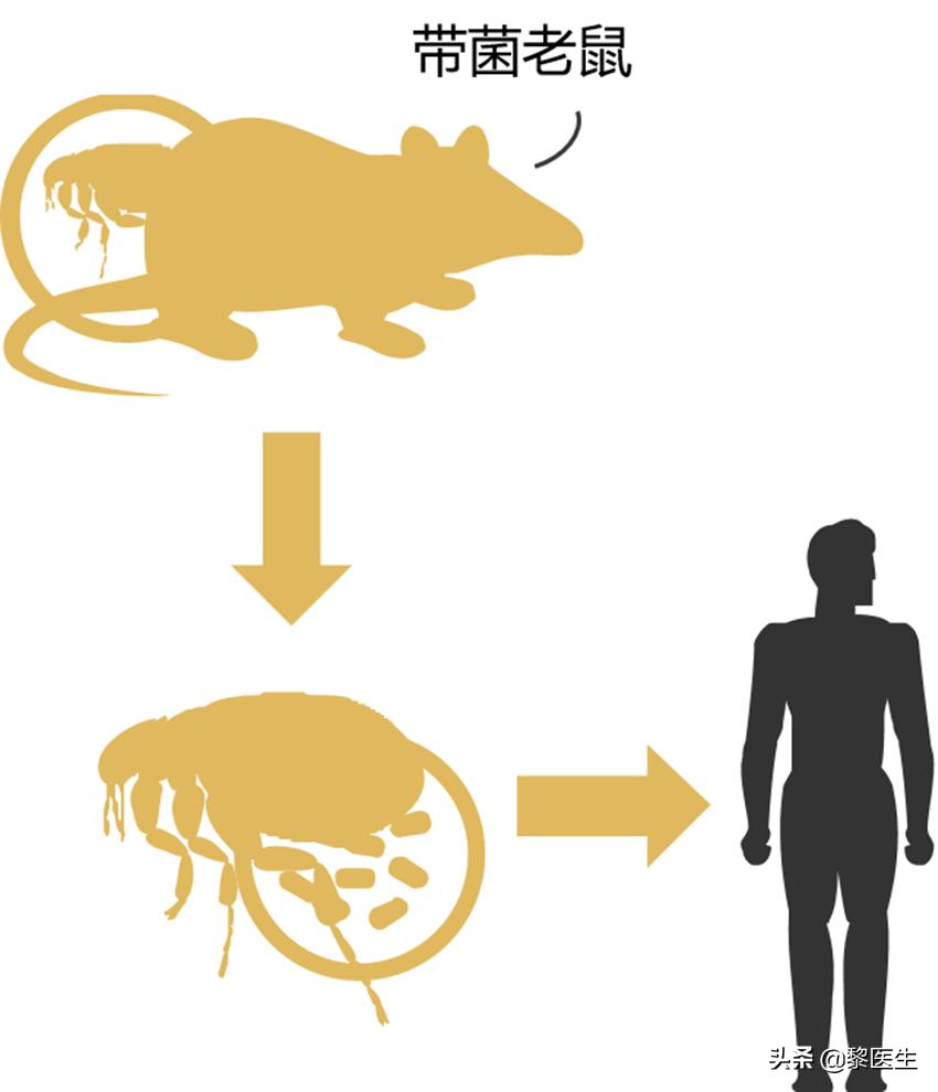 预防鼠疫喝板蓝根管用吗,预防控制鼠疫的主要措施