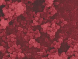 布鲁菌病讲解,布鲁氏菌的科普文章