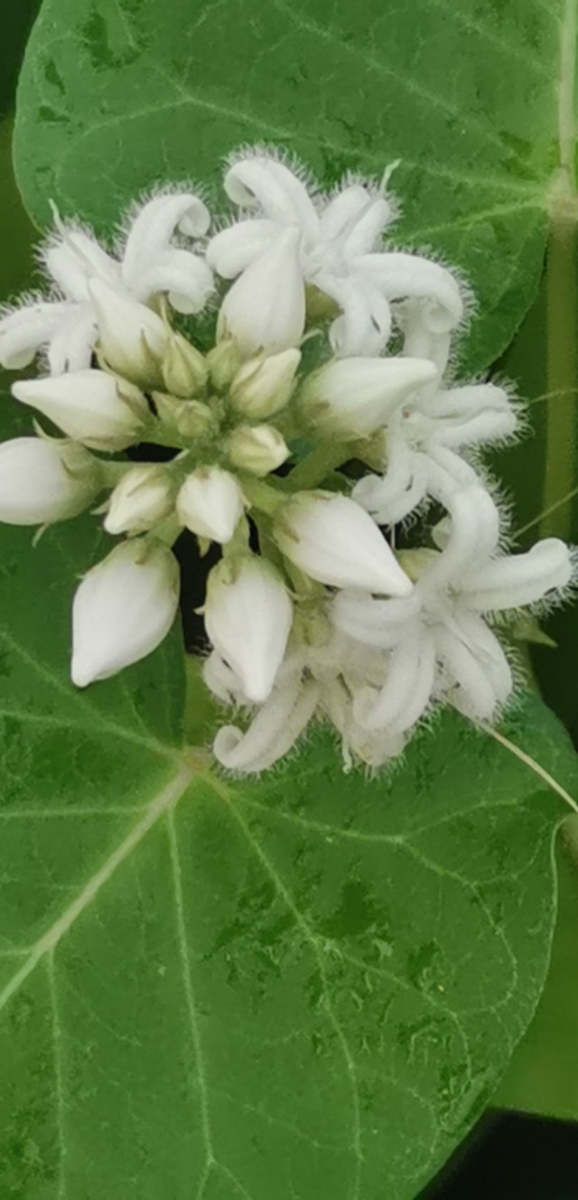 针刺麻醉太神奇了,针刺镇痛与辅助麻醉的原理视频