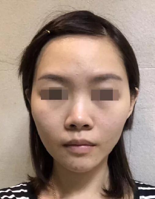 韦敏做鼻子怎么样,韦敏鼻子