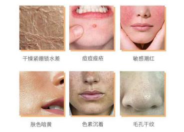 美肌工坊舒缓修复效果怎么样,痘痘肌修复维稳精华