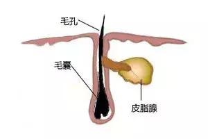 卸妆水可以去除鼻子上的黑头吗,鼻子上的黑头去除后怎么收缩毛孔