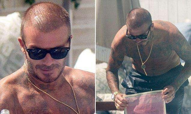 贝克汉姆怎么治疗脱发,贝克汉姆脱发的原因